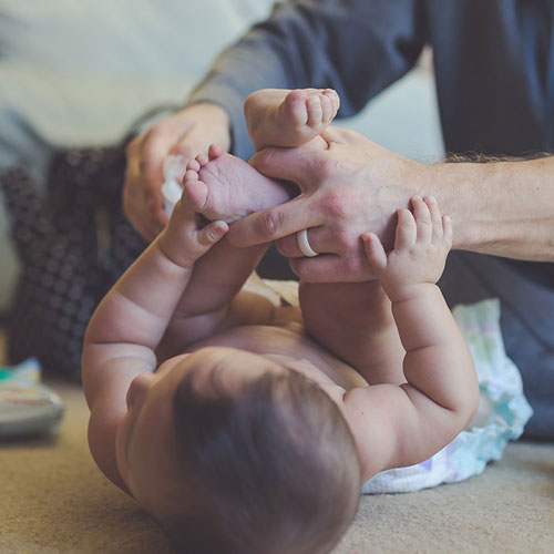 درمان سوختگی پای نوزاد با بهترین کرم و پماد سوختگی پای نوزاد